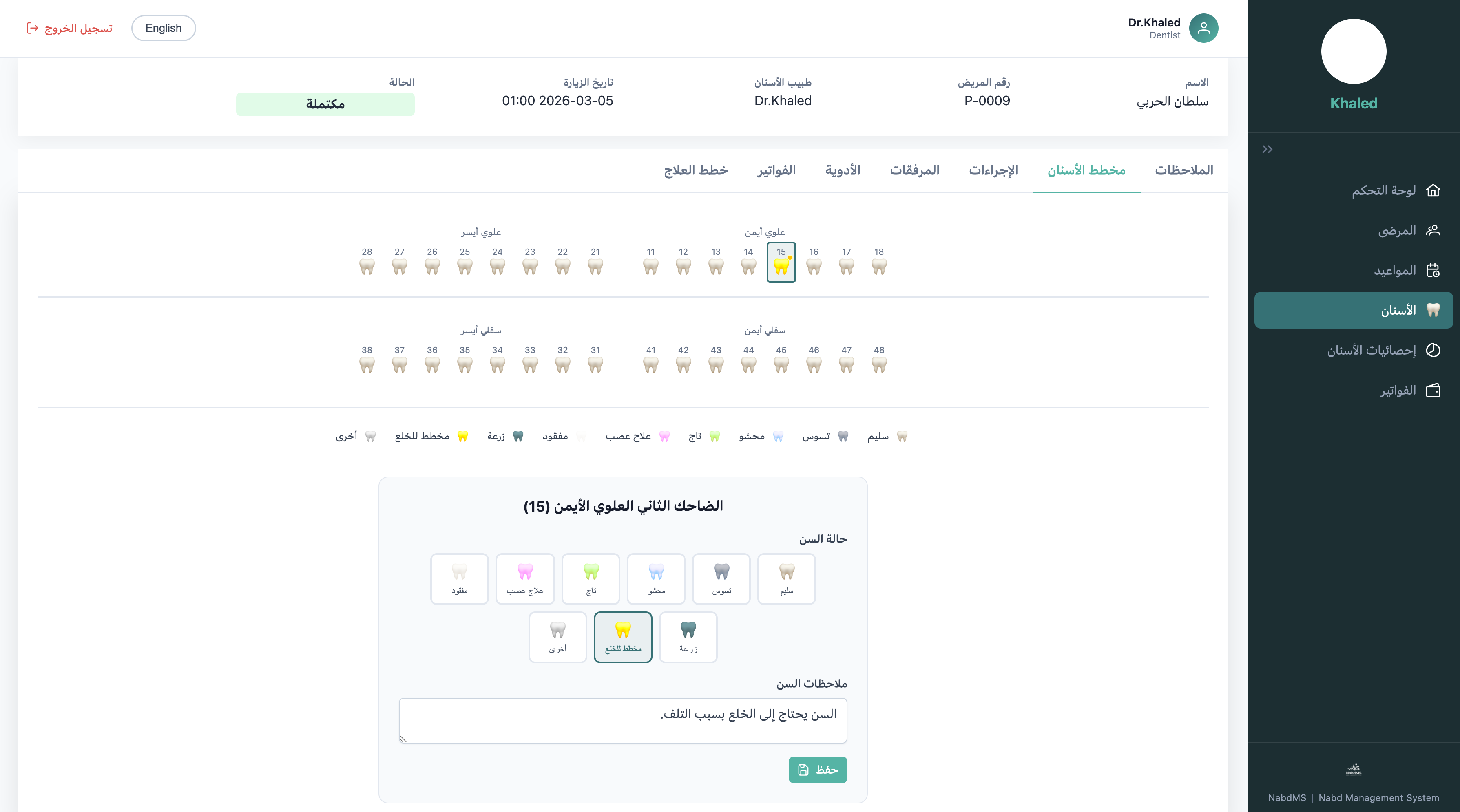 مخطط الأسنان التفاعلي — إجراءات لكل سن